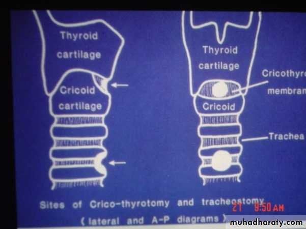 larynx