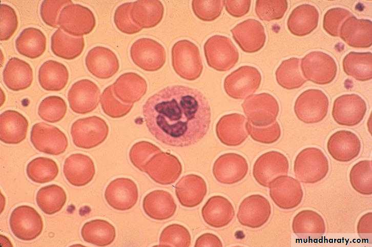 Red Blood Cells Disorders