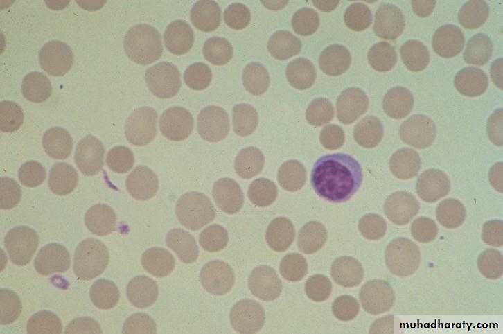 Red Blood Cells Disorders