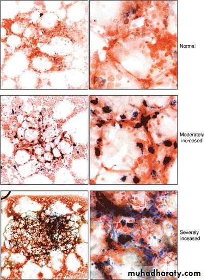 Red Blood Cells Disorders