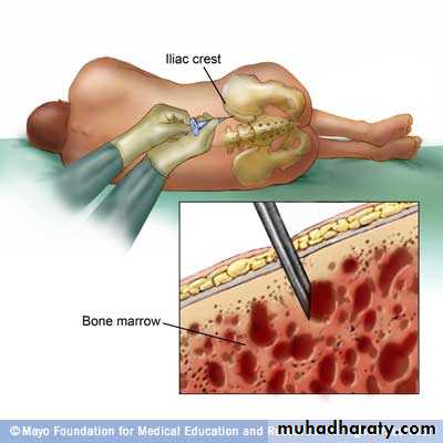 Red Blood Cells Disorders