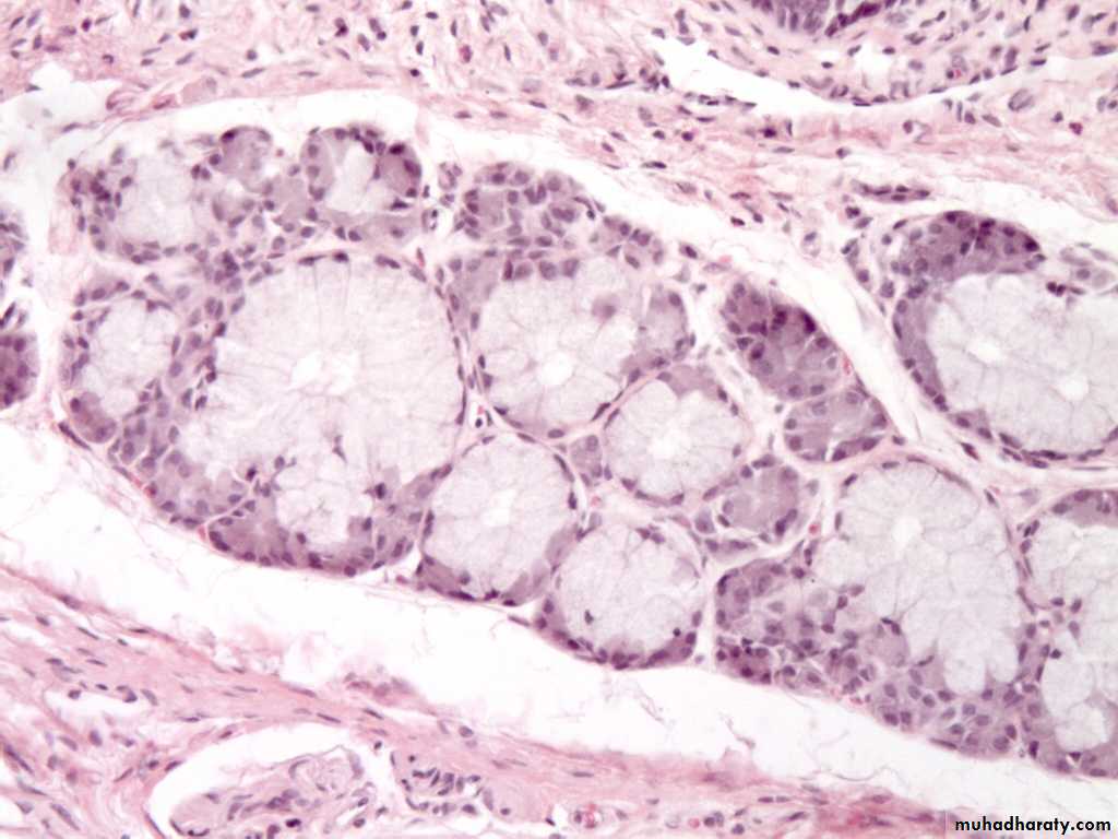 granular epithelial tissue