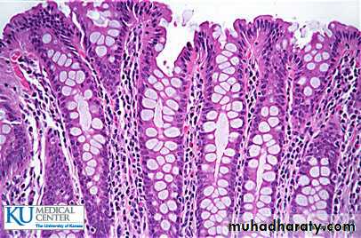 granular epithelial tissue