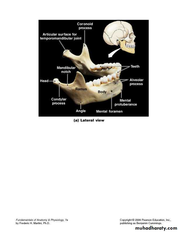 condylar injury