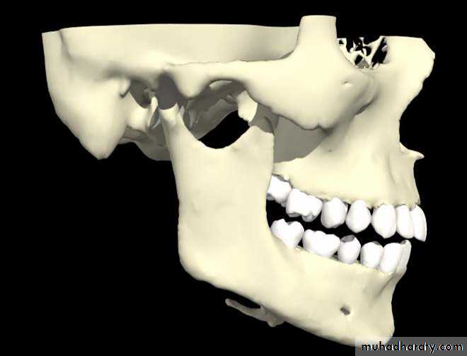 condylar injury