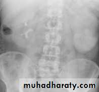 urinary system
