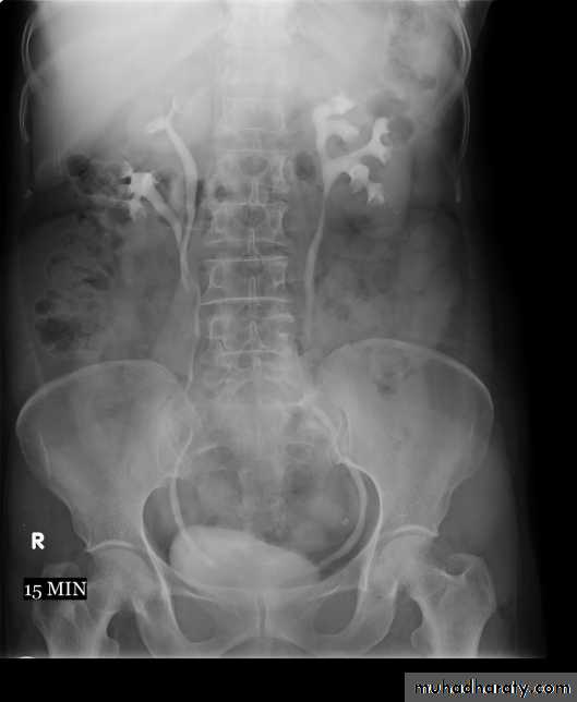 urinary system