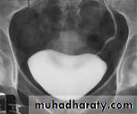 urinary system