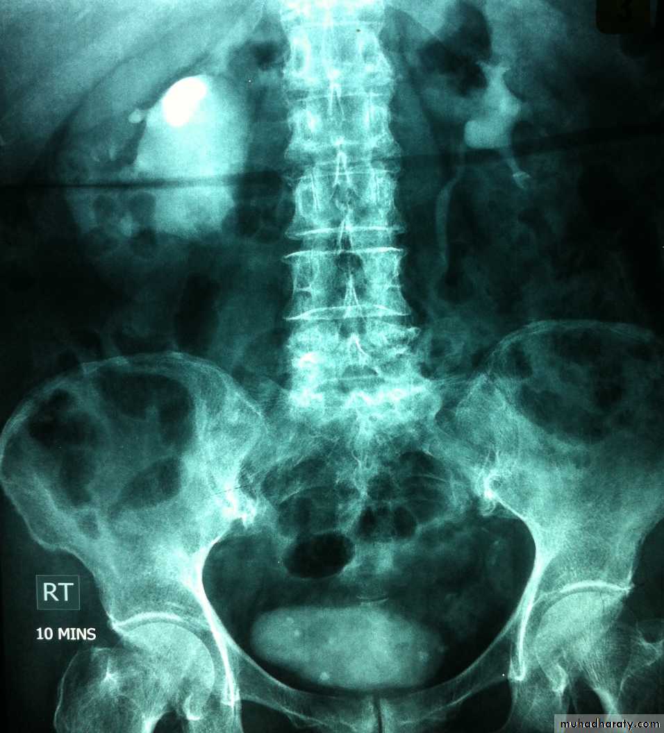 urinary system