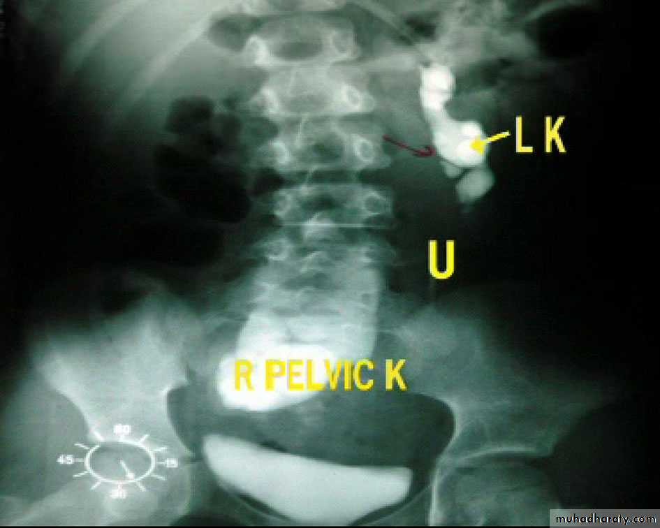 urinary system