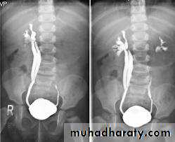 urinary system