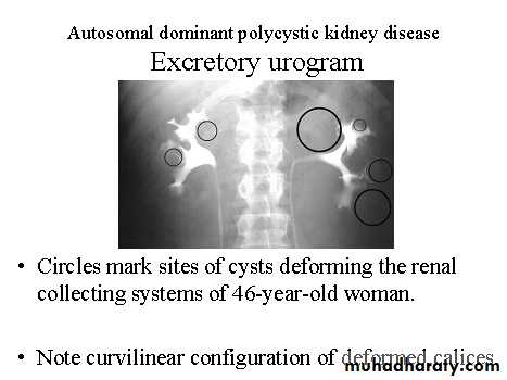 urinary system