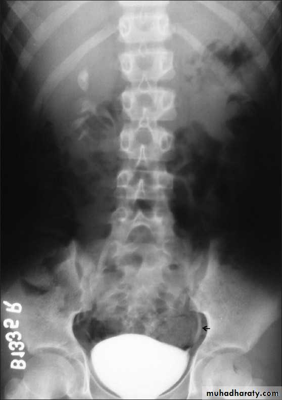 urinary system