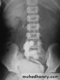 urinary system