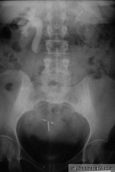 urinary system