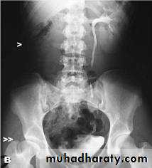 urinary system