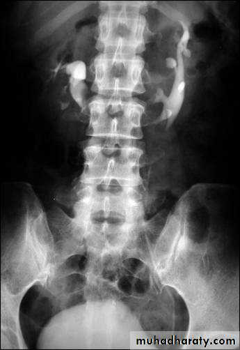 urinary system