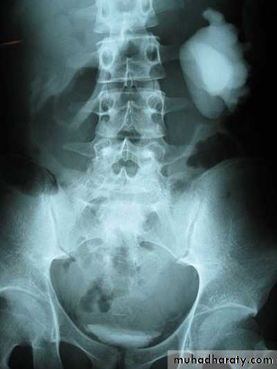 urinary system