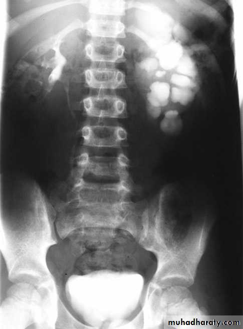 urinary system
