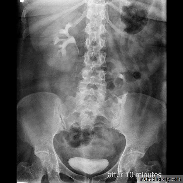 urinary system