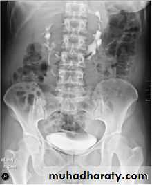 urinary system