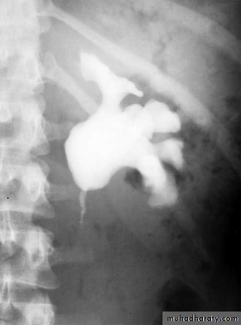 urinary system