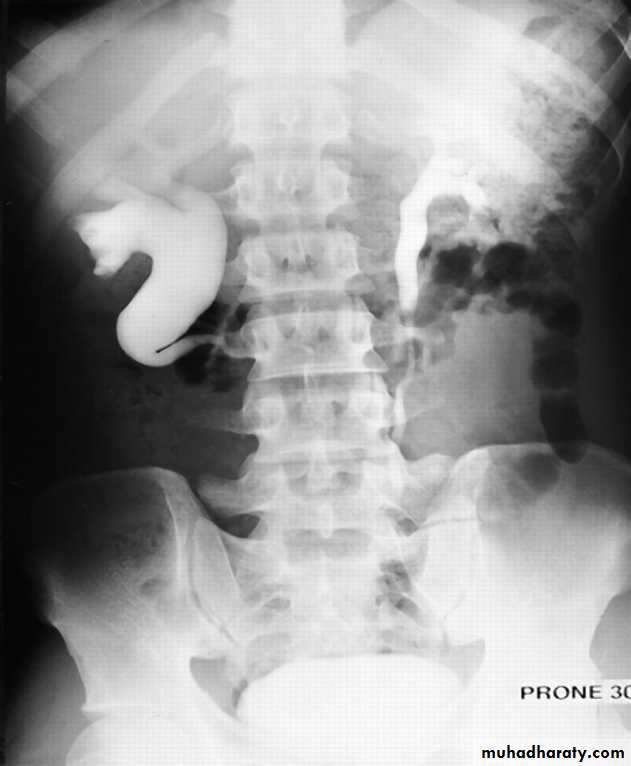 urinary system