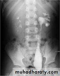 urinary system