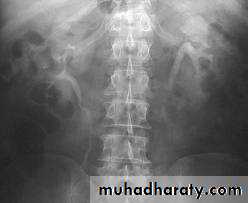 urinary system