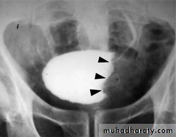 urinary system