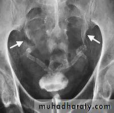urinary system