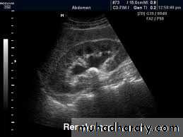 urinary system