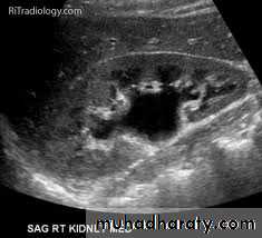 urinary system