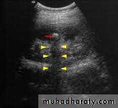 urinary system