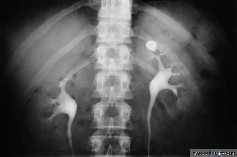 urinary system