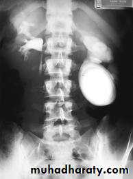 urinary system