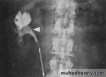 urinary system