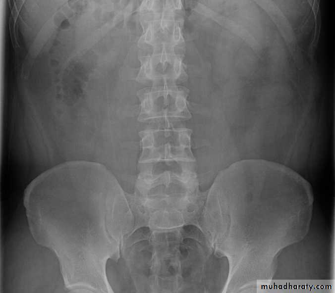 urinary system