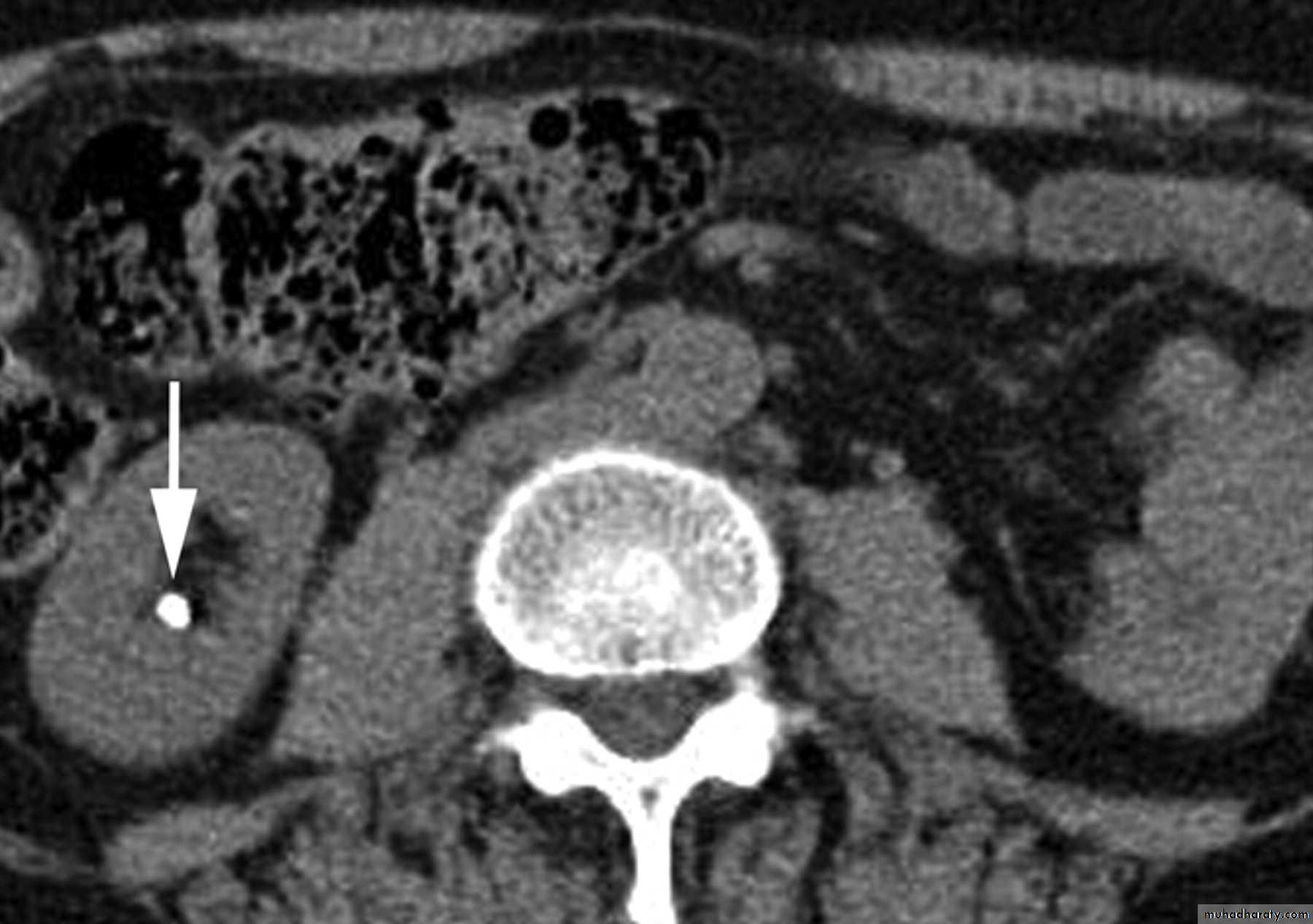 urinary system