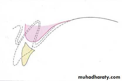 Selection of teeth