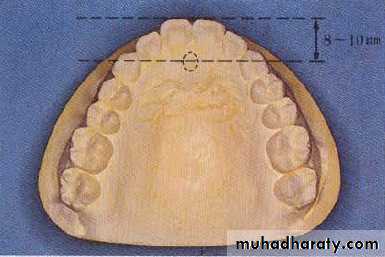 Selection of teeth