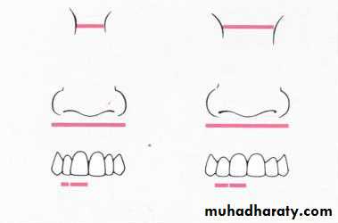 Selection of teeth