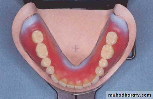 Selection of teeth