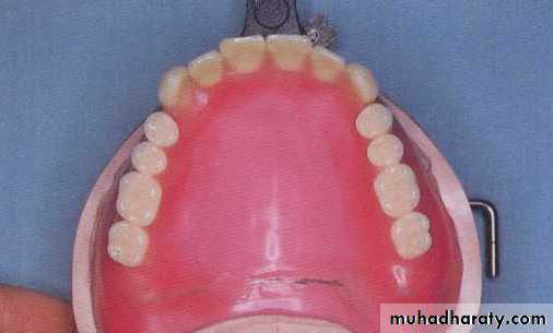 Selection of teeth
