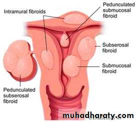 early pregnancy bleeding
