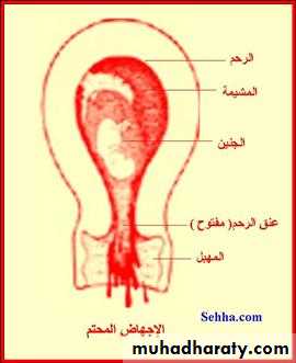 early pregnancy bleeding