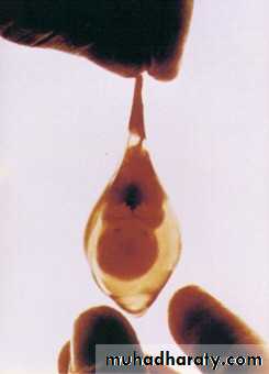 early pregnancy bleeding