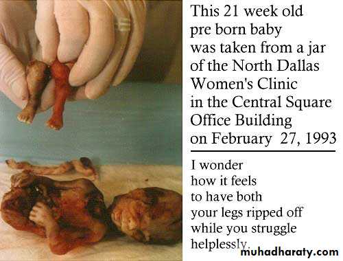 early pregnancy bleeding