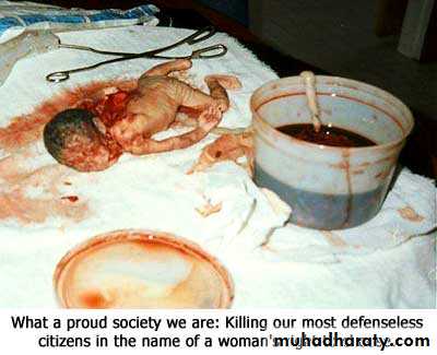early pregnancy bleeding