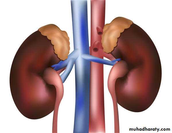 ACUTE GLOMERULONEPHRITIS